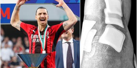 Zlatan Ibrahimovic on his knee injury: I've never suffered so much