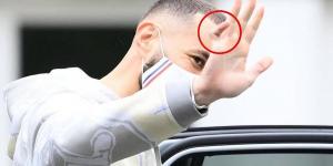 Why does Benzema always wear a bandage on his hand? How long has worn it?