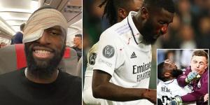 Real Madrid hero Antonio Rudiger jokes he is still 'alive' after he was 'left needing 20 stitches' having been PUNCHED in the face heading in a 95th-minute equaliser against Shakhtar Donetsk in the Champions League