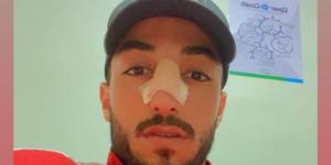 تطورات حالة محمد عبدالمنعم بعد إجراء جراحة في الأنف