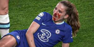 إصابة قوية لـ ميلاني ليويولز لاعبة تشيلسي أمام ليون في ربع نهائي دوري أبطال أوروبا