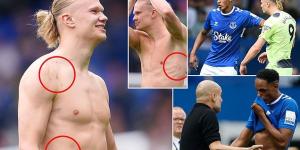 Shirtless Erling Haaland shows off his battle scars after clashing with Yerry Mina, which led to Pep Guardiola confronting Everton's centre back for 'unnecessary behaviour' in clash over the dark arts