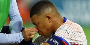 Kylian Mbappe 'set to MISS a chunk of Euro 2024' with his broken nose stopping him from playing, new report in France reveals... but it might not help England's chances