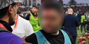 أعمال شغب من طرف جماهير اتحاد العاصمة تسفر عن إصابة أحد الصحفيين في مباراة أولمبيك آسفي!