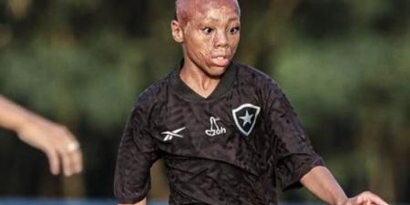 برناردو موهبة البرازيل الذي تحدى الحروق يوجه طلب خاص لكريستيانو رونالدو