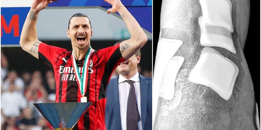Zlatan Ibrahimovic on his knee injury: I've never suffered so much