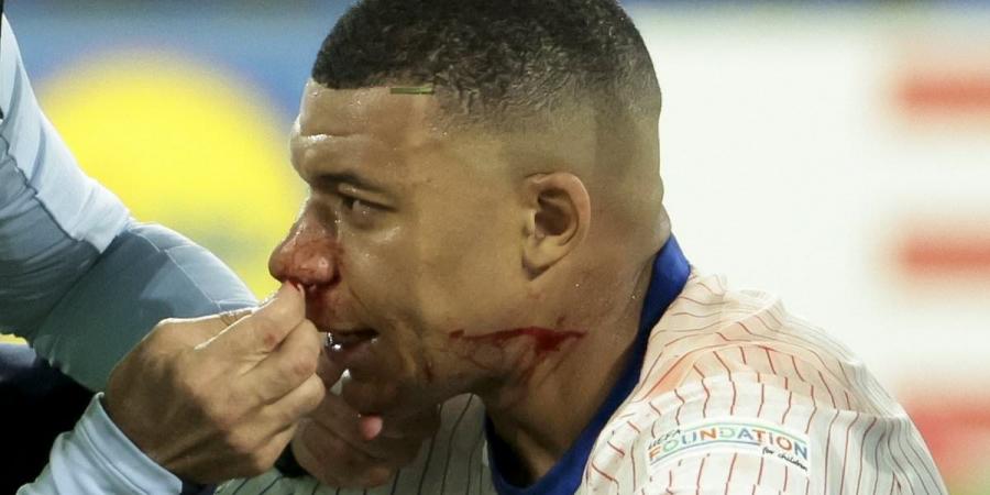 Cesc Fabregas says Kylian Mbappe will have NO excuses despite requiring a mask after suffering a broken nose in France's opening game at Euro 2024